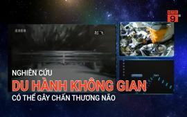 nghien-cuu-du-hanh-khong-gian-co-the-gay-chan-thuong-nao