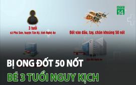 bi-ong-dot-50-not-be-3-tuoi-nguy-kich